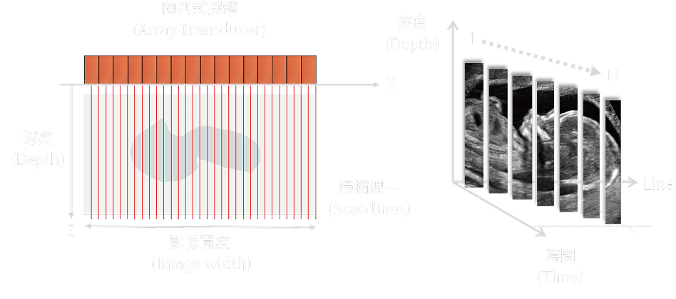 超音波成像