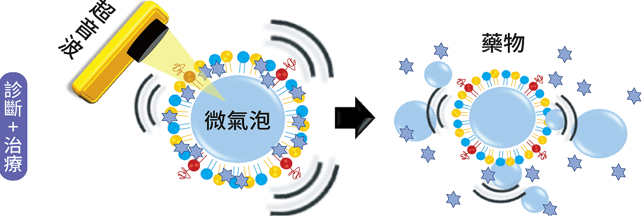 超音波影像顯影劑